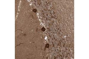 Immunohistochemical staining of human cerebellum with C10orf113 polyclonal antibody  shows strong cytoplasmic nucleolar positivity in Purkinje cells at 1:50-1:200 dilution.