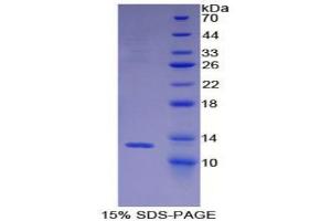 SDS-PAGE analysis of Mouse BRAK Protein. (CXCL14 蛋白)