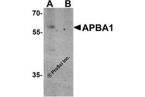 Western Blotting (WB) image for anti-Amyloid beta (A4) Precursor Protein-Binding, Family A, Member 1 (APBA1) (N-Term) antibody (ABIN1031230)