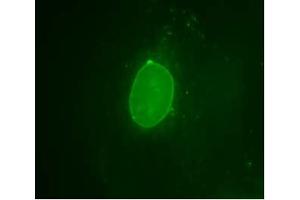 Image no. 2 for anti-Emerin (EMD) (AA 114-183) antibody (ABIN303590) (Emerin 抗体  (AA 114-183))