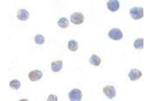 Immunocytochemistry of IKK alpha in Jurkat cells with AP30403PU-N IKK alpha antibody at 1μg/ml. (IKK alpha 抗体  (C-Term))