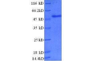 SDS-PAGE (SDS) image for Zinc Finger, BED-Type Containing 1 (ZBED1) (AA 1-210), (partial) protein (GST tag) (ABIN7479603)