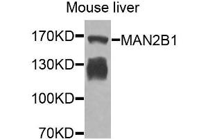 Western blot analysis of extracts of mouse liver, using MAN2B1 antibody (ABIN6003645) at 1/1000 dilution. (MAN2B1 抗体)