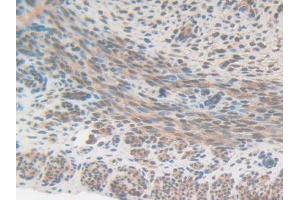 IHC-P analysis of Mouse Uterus Tissue, with DAB staining. (CS 抗体  (AA 174-428))