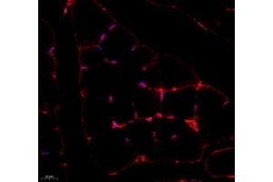 Immunofluorescence (Paraffin-embedded Sections) (IF (p)) image for anti-SET and MYND Domain Containing 2a (SMYD2A) antibody (ABIN7075581)