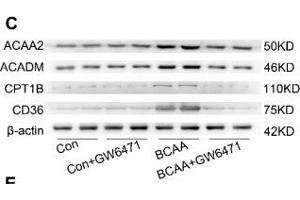 BCAA upregulate PPAR-α and PPAR-α targeted genes. (Medium-Chain Specific Acyl-CoA Dehydrogenase, Mitochondrial (MCAD) (AA 1-220) 抗体)