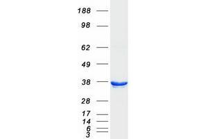 Western Blotting (WB) image for AlkB, Alkylation Repair Homolog 3 (ALKBH3) protein (Myc-DYKDDDDK Tag) (ABIN2714579)