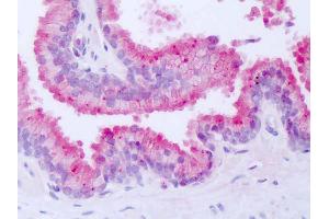 Anti-NR1D1 antibody IHC of human prostate. (NR1D1 抗体  (Internal Region))