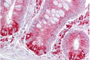 Immunohistochemistry with Small intestine tissue at an antibody concentration of 5µg/ml using anti-PDIA6 antibody (ARP52103_P050) (PDIA6 抗体  (Middle Region))