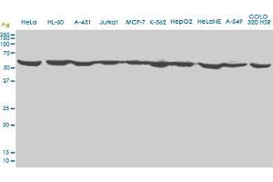 EPOR monoclonal antibody (M01), clone 3D10. (EPOR 抗体  (AA 31-130))