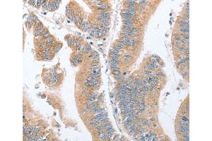 Immunohistochemistry (IHC) image for anti-Par-6 Partitioning Defective 6 Homolog alpha (PARD6A) antibody (ABIN2421992) (PARD6A 抗体)