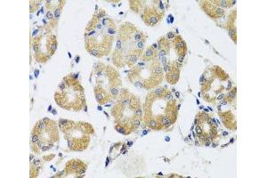 Immunohistochemistry of paraffin-embedded Human stomach using RAD51C Polyclonal Antibody at dilution of 1:100 (40x lens). (RAD51C 抗体)