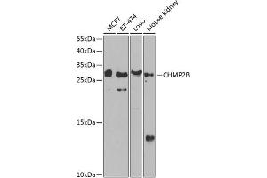 Western blot analysis of extracts of various cell lines, using CHMP2B antibody (ABIN6131571, ABIN6138545, ABIN6138547 and ABIN6217398) at 1:1000 dilution. (CHMP2B 抗体  (AA 1-213))