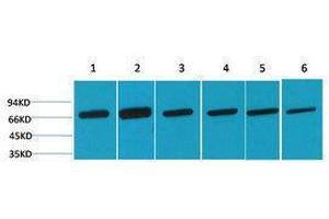 Western Blotting (WB) image for anti-Heat Shock 70kDa Protein 8 (HSPA8) antibody (ABIN3179025) (Hsc70 抗体)
