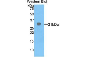 Western blot analysis of the recombinant protein. (APAF1 抗体  (AA 872-1135))