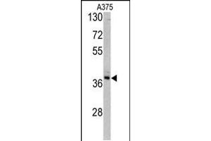 Western blot analysis of TALDO1 antibody in A375 cell line lysates (35ug/lane) (TALDO1 抗体  (AA 186-215))