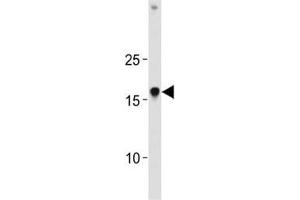 HMGA1 antibody western blot analysis in K562 lysate (HMGA1 抗体  (AA 64-93))