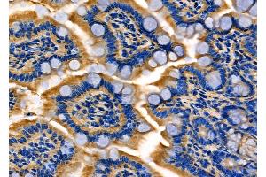 ABIN6260403 and ABIN6277987 at 1/100 staining Mouse colorectal tissue by IHC-P.