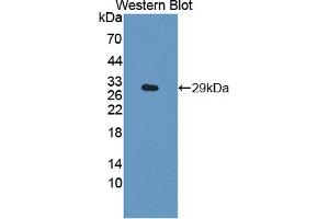 Western blot analysis of the recombinant protein. (DIXDC1 抗体  (AA 485-683))