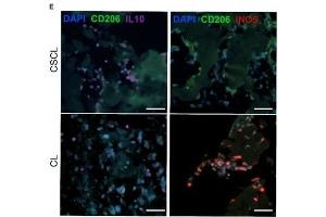 Characterization of infiltrating cells at day 1 post implant. (IL-10 抗体  (AA 101-178))