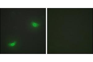 Immunofluorescence analysis of HepG2 cells, using DUSP16 antibody. (DUSP16 抗体)