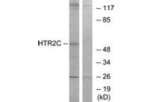 Western Blotting (WB) image for anti-5-Hydroxytryptamine (serotonin) Receptor 2C (HTR2C) (AA 395-444) antibody (ABIN2890745) (HTR2C 抗体  (AA 395-444))