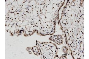 Immunoperoxidase of monoclonal antibody to H2AFV on formalin-fixed paraffin-embedded human placenta. (H2AFV 抗体  (AA 1-128))