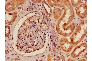 Immunohistochemistry of paraffin-embedded human kidney tissue using ABIN7151839 at dilution of 1:100 (EPH Receptor A4 抗体  (AA 345-545))