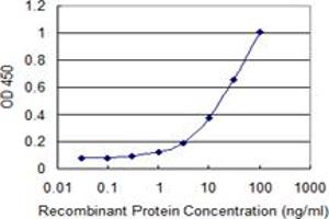 Detection limit for recombinant GST tagged KRT5 is 0. (Cytokeratin 5 抗体  (AA 1-590))