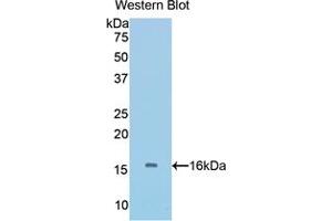Western blot analysis of the recombinant protein. (BMP5 抗体  (AA 201-314))
