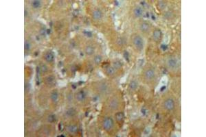 Used in DAB staining on fromalin fixed paraffin-embedded Liver tissue (MEPE 抗体  (AA 212-445))