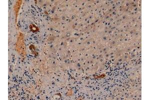 Immunohistochemistry (IHC) image for anti-Keratin 19 (KRT19) (AA 245-391) antibody (ABIN7427978)