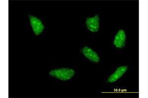 Immunofluorescence of monoclonal antibody to HOXA5 on HeLa cell. (HOXA5 抗体  (AA 171-270))