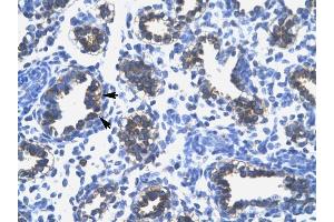 RPS16 antibody was used for immunohistochemistry at a concentration of 4-8 ug/ml to stain Alveolar cells (arrows) in Human Lung. (RPS16 抗体  (N-Term))