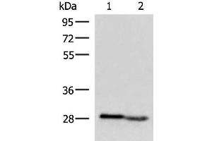 Western blot analysis of Human fetal intestines tissue and Human fetal liver tissue lysates using KLRB1 Polyclonal Antibody at dilution of 1:800 (CD161 抗体)