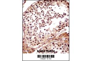 TNKS Antibody immunohistochemistry analysis in formalin fixed and paraffin embedded human testis tissue followed by peroxidase conjugation of the secondary antibody and DAB staining. (TNKS 抗体  (N-Term))