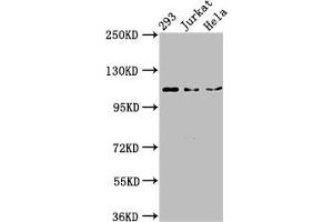 Western Blot Positive WB detected in: 293 whole cell lysate, Jurkat whole cell lysate, Hela whole cell lysate All lanes: NEDD4L antibody at 3 μg/mL Secondary Goat polyclonal to rabbit IgG at 1/50000 dilution Predicted band size: 112, 105, 101, 99, 111, 110, 97 kDa Observed band size: 112 kDa (NEDD4-2 抗体  (AA 289-494))