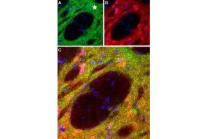 Expression of DRD1 in rat striatum - Immunohistochemical staining of perfusion-fixed frozen brain sections with Anti-D1 Dopamine Receptor Antibody (ABIN7043105, ABIN7044227 and ABIN7044228), (1:100), (green). (Dopamine Receptor d1 抗体  (C-Term, Intracellular))