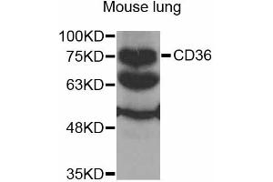 Western blot analysis of extracts of mouse lung, using CD36 antibody (ABIN2561720) at 1:1000 dilution. (CD36 抗体)