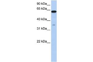 WB Suggested Anti-KPNA6 Antibody Titration: 0. (KPNA6 抗体  (N-Term))