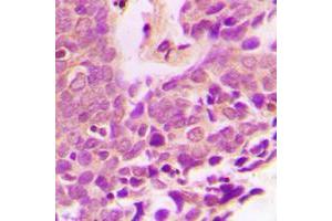 Immunohistochemistry (IHC) image for anti-X-Linked Inhibitor of Apoptosis (XIAP) (Center) antibody (ABIN7301446)
