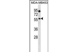 B4GALNT1 Antibody (Center) (ABIN1538263 and ABIN2849848) western blot analysis in MDA-M cell line lysates (35 μg/lane). (B4GALNT1 抗体  (AA 296-323))