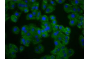 Immunofluorescence staining of HepG2 cells with ABIN7162591 at 1:133, counter-stained with DAPI. (Pannexin 3 抗体  (AA 135-215))