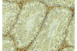 ABIN6268946 at 1/100 staining Mouse testis tissue by IHC-P. (TXNRD2 抗体  (C-Term))
