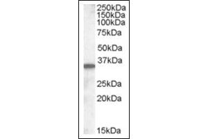Image no. 1 for anti-Solute Carrier Family 10 (Sodium/bile Acid Cotransporter Family), Member 2 (SLC10A2) (C-Term) antibody (ABIN375244) (SLC10A2 抗体  (C-Term))