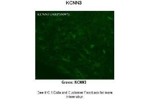 Immunohistochemistry (IHC) image for anti-Small Conductance Calcium-Activated Potassium Channel Protein 3 (KCNN3) (C-Term) antibody (ABIN2776146)