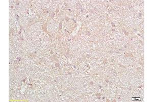 Formalin-fixed and paraffin embedded rat brain tissue with labeled Anti-CD38 Polyclonal Antibody, Unconjugated  at 1:200, followed by conjugation to the secondary antibody and DAB staining (CD38 抗体  (AA 101-200))