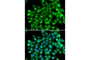 Immunofluorescence analysis of MCF-7 cells using SUFU antibody (ABIN6133029, ABIN6148692, ABIN6148694 and ABIN6217424). (SUFUH 抗体  (AA 325-484))