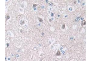 Immunohistochemistry (IHC) image for anti-Profilin 2 (PFN2) (AA 5-140) antibody (ABIN7437743)