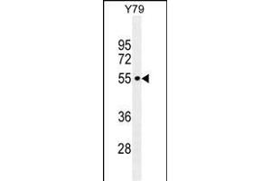 CCDC97 Antibody (C-term) (ABIN655301 and ABIN2844887) western blot analysis in Y79 cell line lysates (35 μg/lane). (CCDC97 抗体  (C-Term))